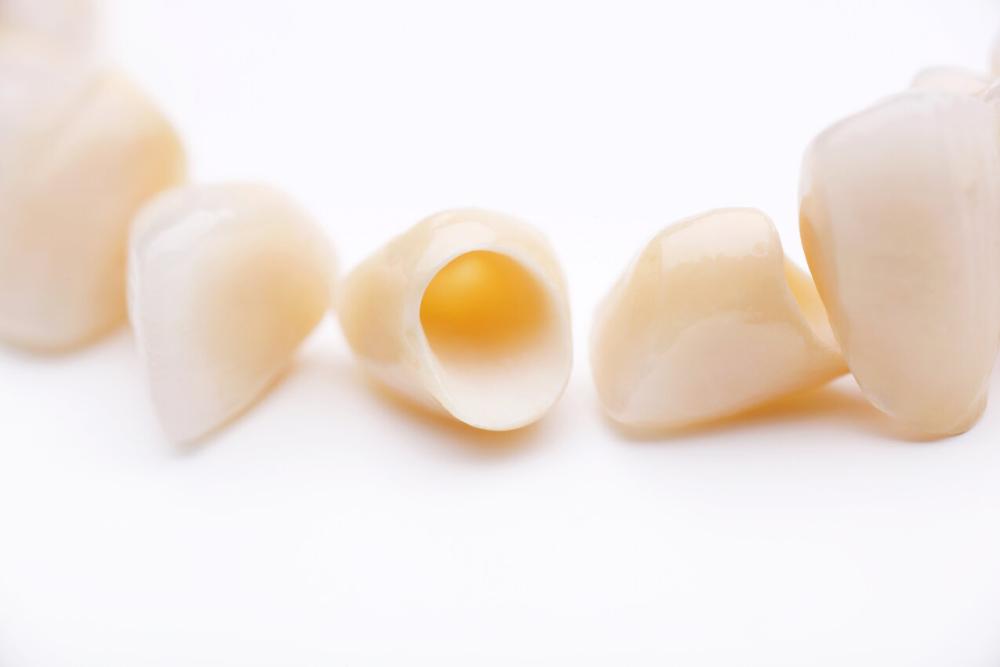 dental crowns from coeur d'alene