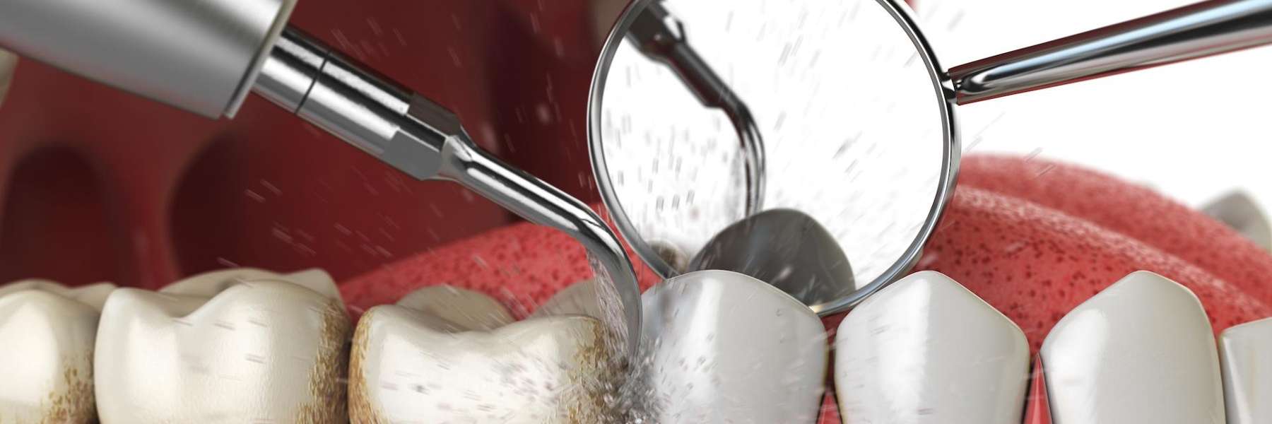 Image of tooth in a mouth getting cleaned, ponderay ID