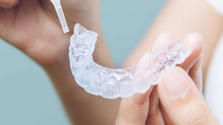image of a teeth whitening kit in ponderay