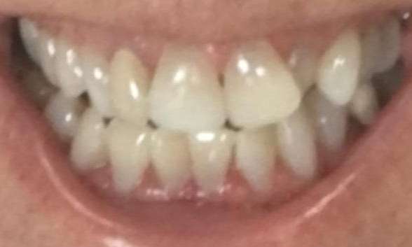 Before treatment - Case 2