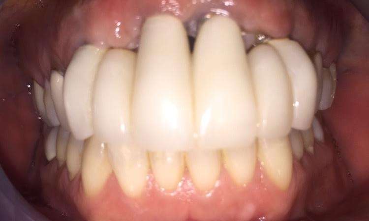 Before treatment - Case 3